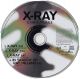 X-Ray (DE, Maxi-CD)